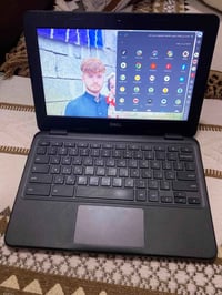 لابتوب • بالة