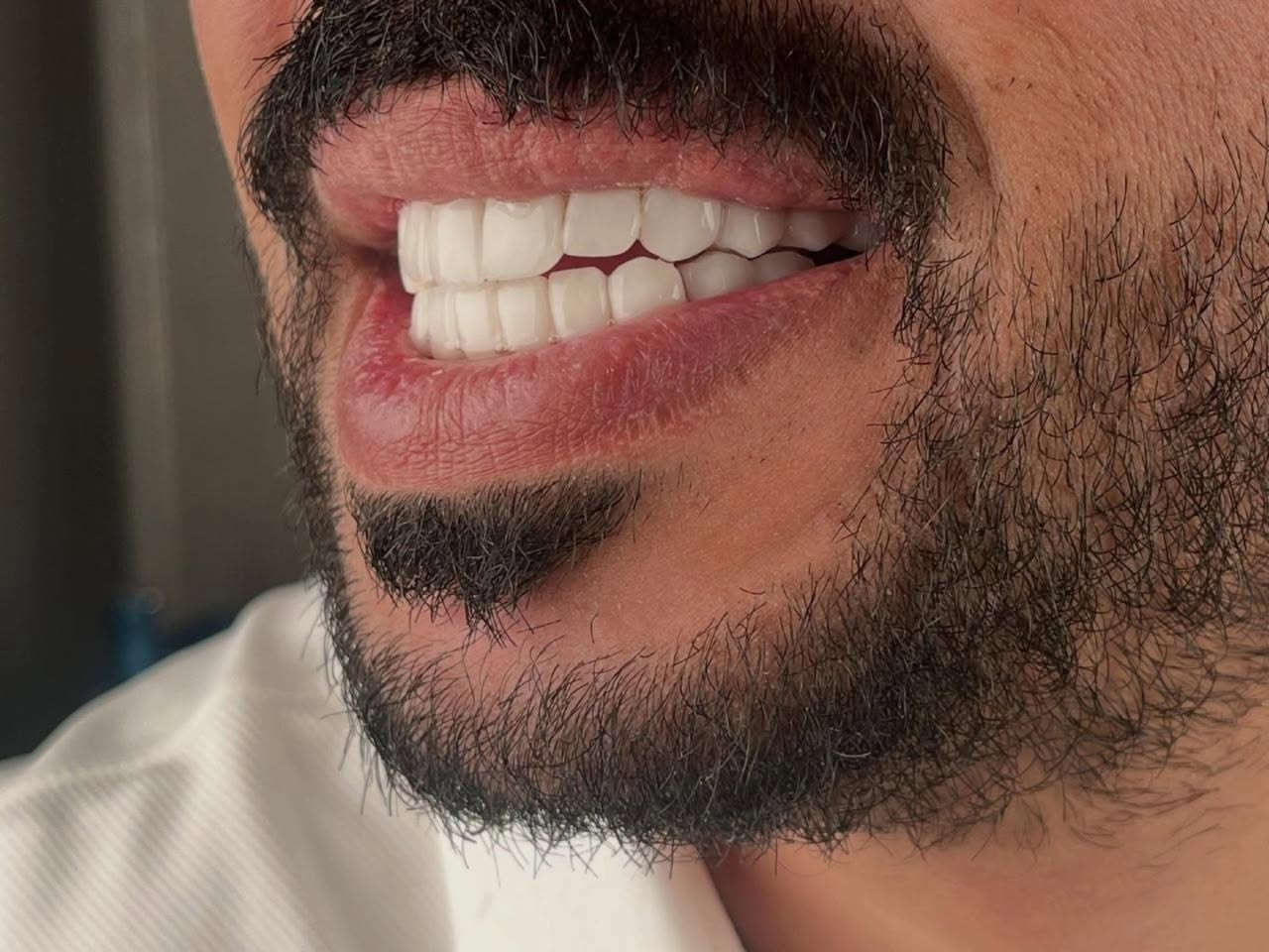 أعتني ب أبتسامتك لأنك تستحق الأفضل 😁😁

في مراكز الشركة الطبية العالمية ، نوفر لك أحدث تقنيات طب الأسنان، وأسهل طرق الدفع.

✅ تقويم الأسنان ✅ تبييض الأسنان ✅ ابتسامة هوليوود
زراعة أسنان 
وحشوات وكتير من الخدمات 

متواجدين داخل المركز طيلة أيام الأسبوع لخدمتكم 

  #عيادة_اسنان #طب_اسنان #كي_كارد #KeeCard #دفع_الكتروني تقويم_اسنان تبييض_الاسنان زراعة_الاسنان ابتسامة جمال صحة

العنوان : طويريج _الشارع العام_مجاور نقابة المعلمين _مقابل المكتبة العامة _مجمع الحارث الطابق الثاني 

رقم الهاتف ***********
                ***********
