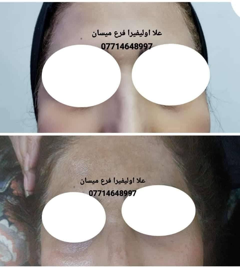 مع بكج العنبر المتكامل ماكو مستحيل 💪 منتجاتي الي اثبتت جدارته 🫶🏻ربي لك الحمد 🤲
عنوانه الثقه وتجاربنا تشهد  🫶 
انتبهو على تجارب كولهن بالارقام الهاتف  افتحو الصوره 
احبكم واحب تجاربكم

نص مكتوب في الصور:
- ***********
- علا اوليفيرا
- +964 773 8997
- معاد توجيهها
- بنان
- 07714
- OLA
- والله منتج يجن جاب نتيجه
- مراسلة
- علا اوليفيرا فرع ميسان
- *********** *********** علا اوليفيرا
- +964 782 280
- ۳ مرات بلسبوع تخلين فقط على بصله الشعر ولازم ينغسل ورا ما يبقى على شعر مده ٣ ساعات او ٤
- ١١:٣٥ م
- يصيرن 35 ١١:٣٦ م
- اكلج حبي وقبل سنه اختي اخدت منج زيت مدري شنو للشعر شنو للعسم مال الجسم
- ١١:٣٧ م
- وهسه ما عدهه شعر جسمهه صار خفيف كلش
- عندج منه
- 077
- OL
- ووجعي يدعيلج عل هل خلطه الحلوه والله اكعد من النوم منوره
- ١١:٣٩ م
- عود بعدني ما حافه
- علا اوليفيرا فرع ميسان ***********
- +964 776 2549 *********** هاي قبل تحضري للجمال *********** BAN يرا 077
- +964 776 2591 الله يعافيج بعد روحي ٥:٢٨ م طمنيني اخذتي صوره قبل وبعد الاستخدام ٥:٢٨ م هاا وصورت الج لان جنت ما صدكه ٥:٢٩ م علا اوليفيرا شوفي الكلوب عد بعضهاا ٥:٣٠ م *********** ٥:٣٠ م شوفي شلون جان مدمر الحنج ٥:٣١ م *********** ٥:٣٢ م صلاوات على محمد شوفت عينج ٥:٣٢ م مراسلة
- +964 786 7121 *********** علا اوليفيرا B A N كيمرر علا اوليفيرا والمسمن بديت بي قبل جم يومم خلاني شكد اكل اهلا وسهلا يقلبي ماشاءالله