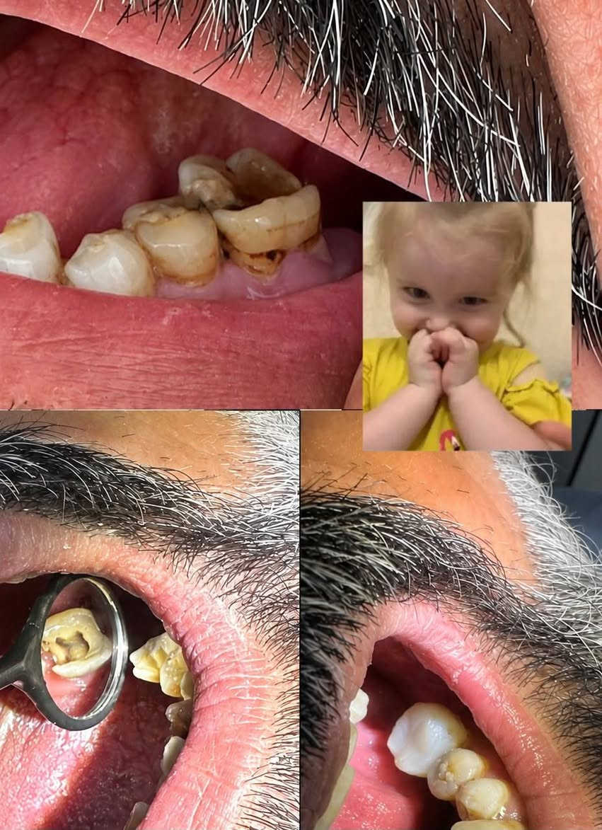 عمل دكتورة فاطمة محمد عارية 🌿🌹
عيادات الاسنان  الدكتور محمد فتين الدريعي 👑🦷🤍
متواجدون طيلة ايام الاسبوع حتى يوم الجمعة و ع مدار ٢٤ ساعة للحالات الطارئة 
د. محمد فتين الدريعي 
د. عفراء محسن ناصر شنيع
د. فاطمة محمد عارية 
 رقم الحجز او لاستفسار //*********** علماً يوجد واتساب 
صحة وعافية للجميع 🌹👑🌿👨‍⚕️
