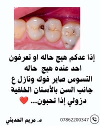 حشوات تجميلية • تعويض جزئي • عيادات كلية السلام