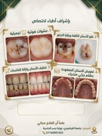 جامعة الفراهيدي • أطباء اختصاص • حشوات ضوئية
