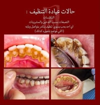 الدورة • جامعة دجلة • عيادة اسنان