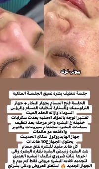 تنظيف عميق • رؤوس سوداء • جهاز هايدروكول