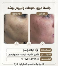 نورونا بعيادتنا 🥰🥰  شنو منتظرين احجزو هسه قبل لا تفوتكم الخصومات 😉  نص...