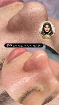 تنظيف بشرة عميق • صالون جوري • قرية الغدير
