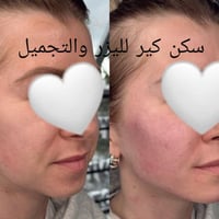شد النسيج • نضارة الوجه • سكن كير
