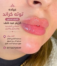 ✨انتي جميلة بس ويانه رح تصيرين اجمل✨    #بعياده تــდــــوته كراند. توت...