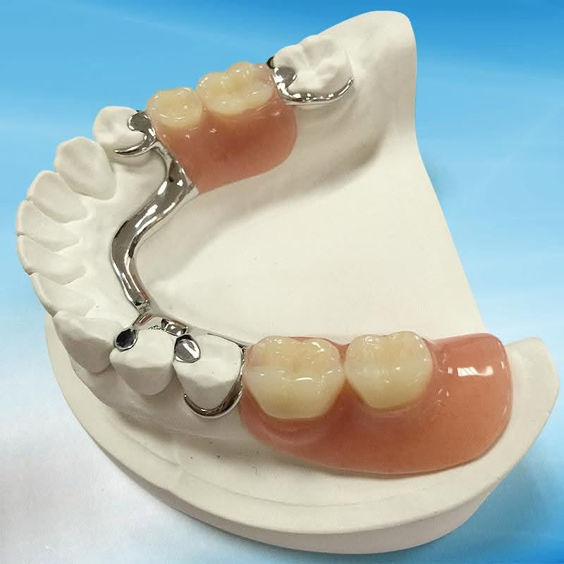 سلام عليكم اطقم متحركة الشغل في العيادات التعليمية في كلية طب الاسنان مقابيل نستشفى الحسين التعليمي 
***********
