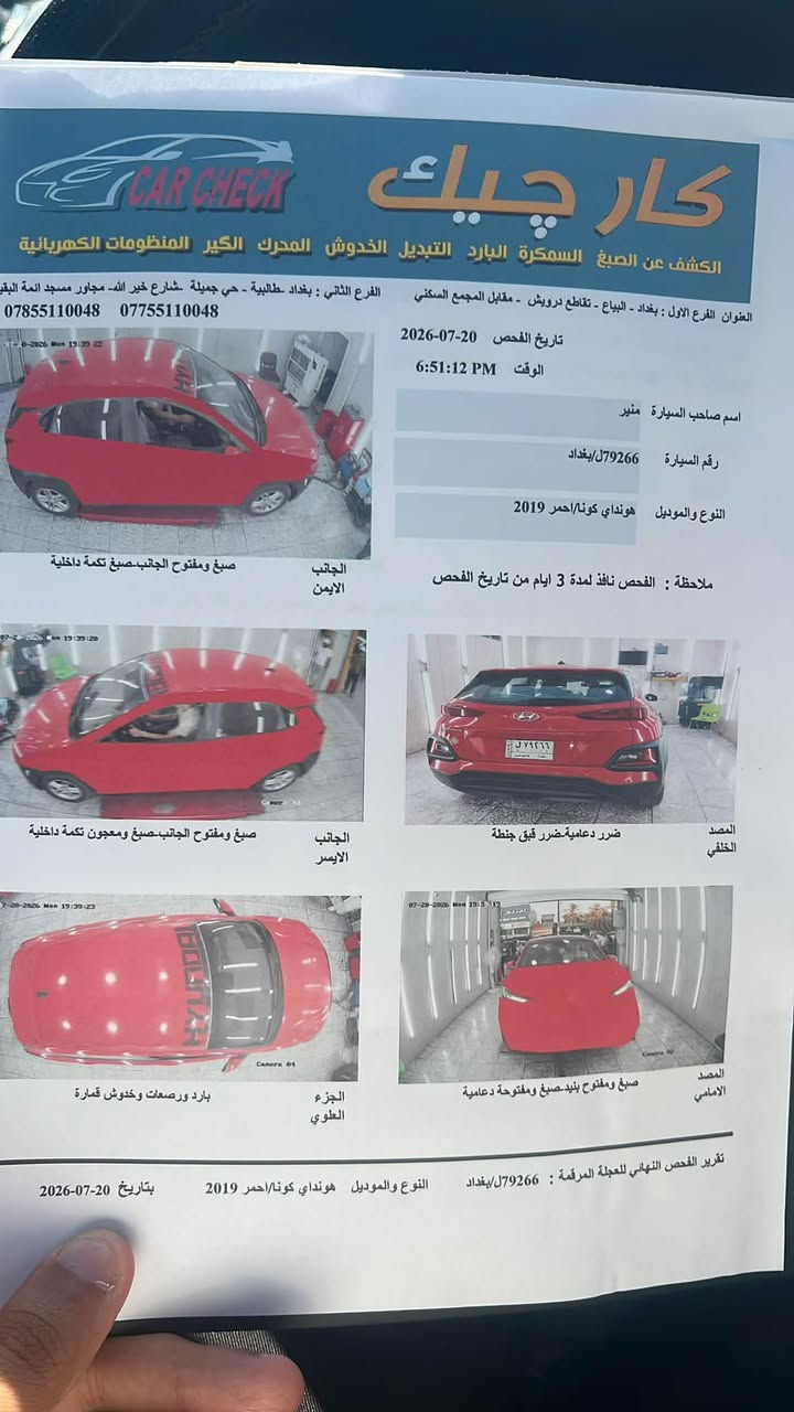 كونا • ٢٠١٩ • كاز كيت
