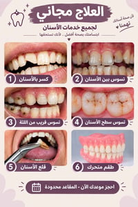 علاج اسنان مجاني • واتساب ماسنجر • مقاعد محدودة