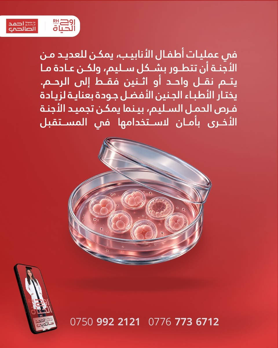 أفضل الأجنة = أعلى فرص نجاح للحمل! 🔬✨

في عمليات أطفال الأنابيب، مو المهم بس عدد الأجنة، الأهم هو جودتها! كادرنا الطبي يختار بعناية أدق أفضل جنين أو اثنين لإرجاعهم للرحم لضمان حمل سليم وناجح.

والأجنة المتبقية؟ يتم تجميدها بأمان تام وبأحدث التقنيات لتكون فرصتكم جاهزة لتوسيع عائلتكم بالمستقبل. خططوا لعائلتكم ويانا بكل ثقة وراحة بال! 🤍

صحتكِ ونجاح حملكِ هما نجاحنا مع مركز روح الحياة، لا يوجد مستحيل 
━━━━━━━━━━━━━━━
 للتواصل وحجز المواعيد:
  اربيل : *********** /***********
 بغداد: *********** | ***********
 موصل : ***********
 الانبار : ***********

العناوين:
 بغداد: العطيفية - مقابل المحكمة الاتحادية
 أربيل: شارع 30 م - قرب القنصلية الإيرانية
 الموصل: حي المصارف - قرب جامع الشهيد مازن
 الأنبار: الرمادي - الشارع العام - بداية شارع ميسلون - مجمع برج المسك
━━━━━━━━━━━━━━━ 
 لمشاهدة قصص النجاح وأحدث فيديوهاتنا، تابعونا عبر الرابط التالي: 
 https://roohalhayat.com/links

نص مكتوب في الصور:
- RH Center من مجموعة الدكتور أحمد الصالحي هل تعلم؟
- من مجموعة الدكتور أحمد الصالحي روح الحياة في عمليات أطفال الأنابيب، يمكن للعديد من الأجنة أن تتطور بشكل سليم، ولكن عادة ما يتم نقل واحد أو اثنين فقط إلى الرحم. يختار الأطباء الجنين الأفضل جودة بعناية لزيادة فرص الحمل السليم، بينما يمكن تجميد الأجنة الأخرى بأمان لاستخدامها في المستقبل. *********** ***********