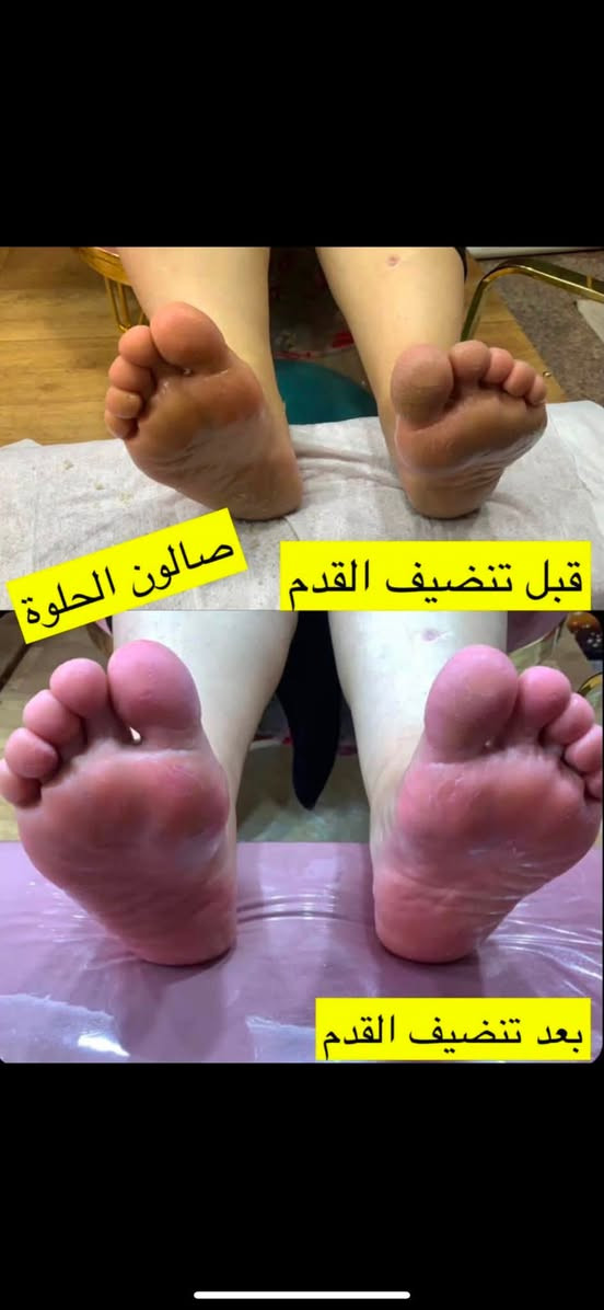مرحبا بنات صالون الحلوه مسوي عروض نار بمناسبت فرحه الزهره سارعو بل حجز العنوان كفائات السيديه صالون الحلوة قرب صيديله مفاتيح الشفاح رقم الحجز ***********
