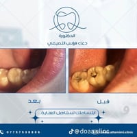 زراعة أسنان • تقويم شفاف • تبييض ليزر