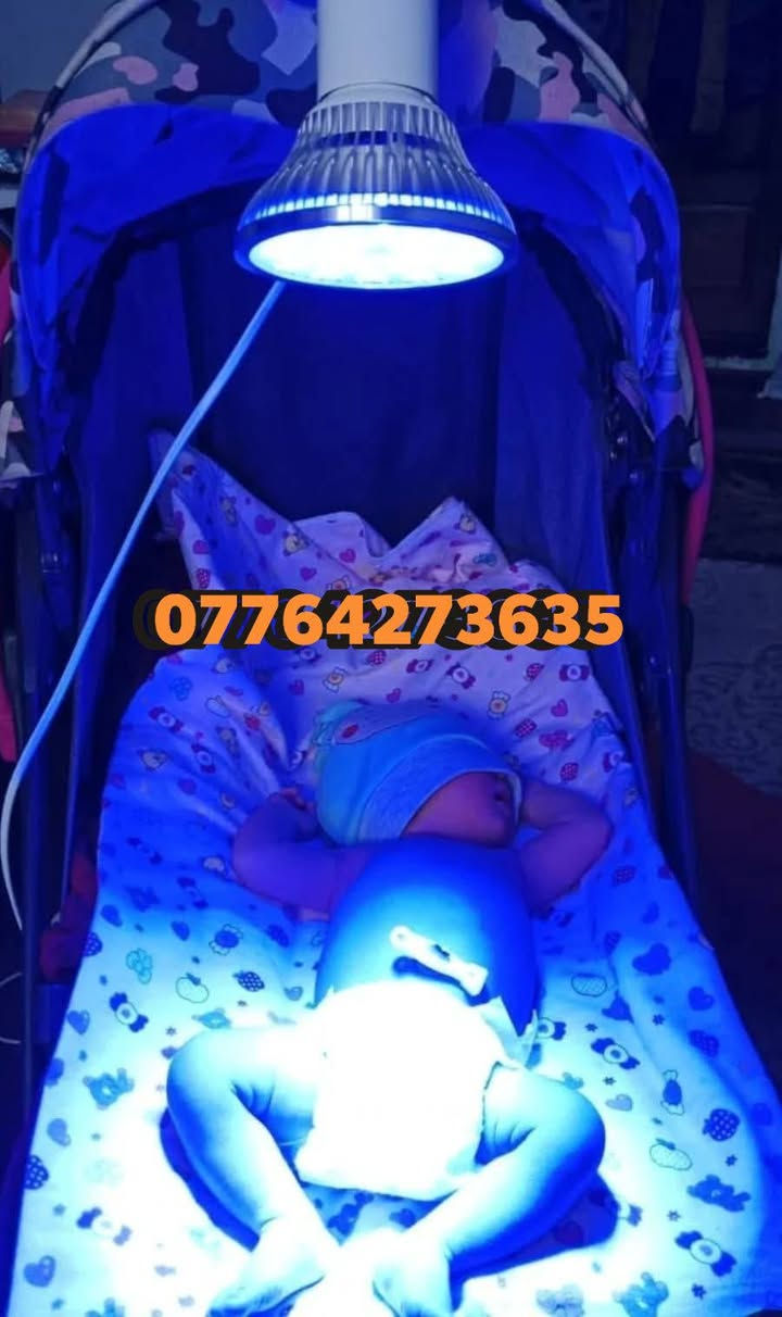 يتوفر اجهزة  phototherapy لعلاج ابوصفار للأطفال الخدج حديثي الولادة
الجهاز فعال جدا ومضمون 
للحجز والاستفسار التواصل واتساب ***********
