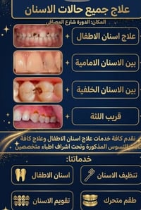 علاج اسنان مجاني • الدورة المصافي • اسنان اطفال