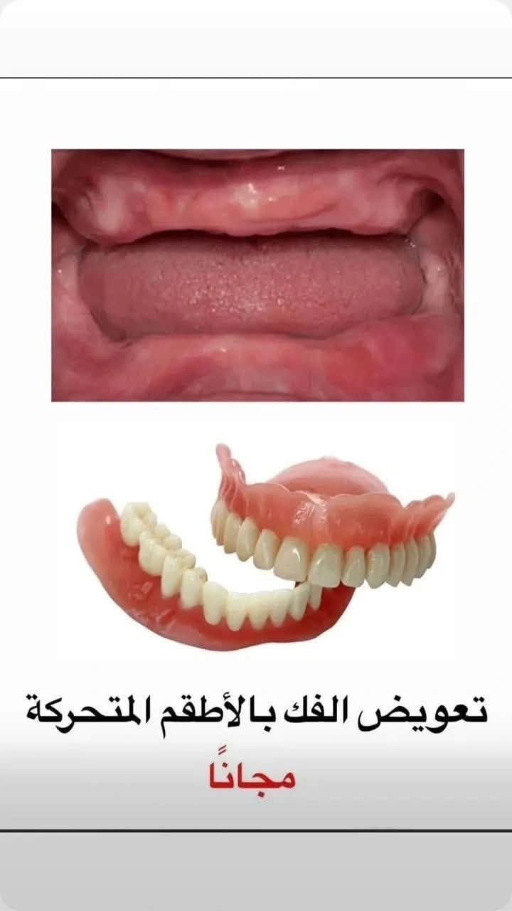 علاج مجاني • تقويم أطفال • جامعة ابن سينا
