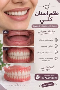 طقم اسنان كامل • مظهر طبيعي • ثبات ممتاز