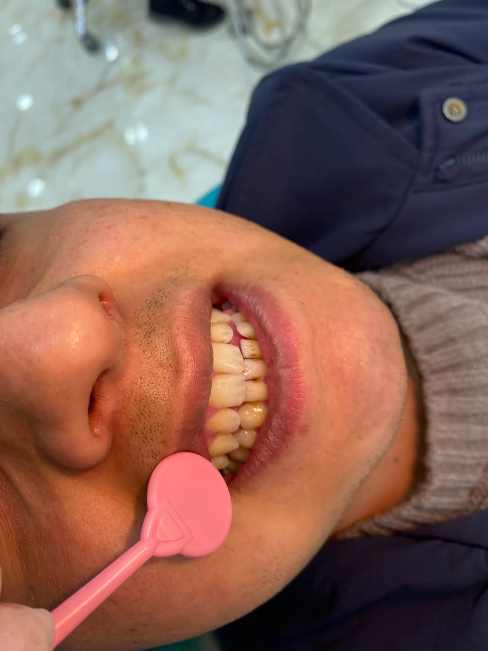 السلام عليكم 
 حشوات  تجميليه ، قلع جذور متبقيه وقلع جراحي 
تنظيف الأسنان من التكلسات والتصبغات 
كُل هذا تحت إشراف دكاتره مختصين 
علماً العلاج مجاني 🔥🔥 
العنوان : حي النقيب عيادات جامعه الصفوه 
للحجز ؏ هذا الرقم :***********
