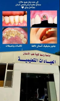 فحص أسنان • تكلسات وتصبغات • عيادات جامعة واسط