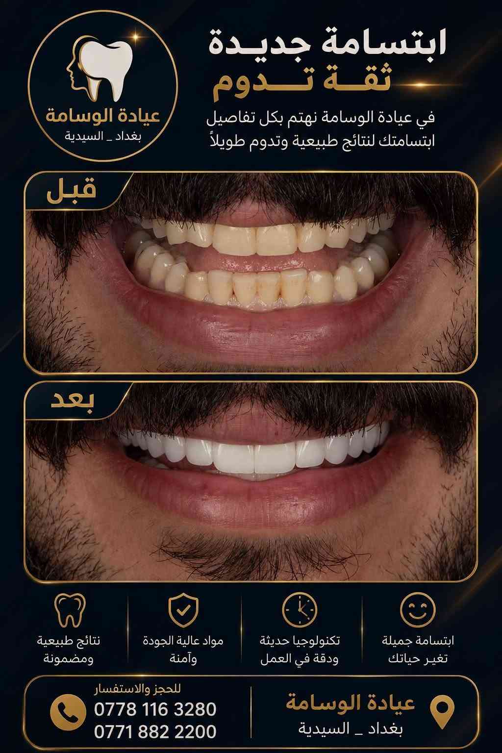 ابتسامة أحلامك وإطلالة أنيقة تبدأ من هنا! ✨🦷💖
يسعدنا في [عيادة الوسامة] استقبالكم وتقديم أرقى الخدمات الطبية والتجميلية بخبرة عالية واهتمام خاص.

​💎 خدمات طب الأسنان:
​تبييض الأسنان بالليزر للحصول على ابتسامة هوليوود ناصعة.
​زراعة وتلبيس الأسنان بأفضل الخامات العالمية.
​تقويم الأسنان وعلاج اللثة.
​العلاج التجميلي والترميمي بدون ألم.

​🌸 خدمات التجميل :
​جلسات النضارة 
ابر (فيلر، بوتوكس).

​أحدث تقنيات شد وتجديد شباب الجلد.
​📍 العنوان: 
[بغداد _ السيدية _ شارع الخيزران بجانب مازن كيتو]
📞 للحجز والاستفسار: 
​***********
​***********
💬 أو راسلونا مباشرة عبر الصفحة لتحديد مواعيدكم.

نص مكتوب في الصور:
- عيادة الوسام
- الدكتور
- محمود سامي الزبيدي
- لطب وتجميل الأسنان
- ***********
- ***********
- السيدية شارع الخيزران مجاور مندي
- بوابة اليمن وقابل قهوة ساو
- ابتسامة جديدة ثقة تدوم في عيادة الوسامة نهتم بكل تفاصيل ابتسامتك لنتائج طبيعية وتدوم طويلاً قبل بعد نتائج طبيعية ومضمونة مواد عالية الجودة وآمنة تكنولوجيا حديثة ودقة في العمل ابتسامة جميلة تغير حياتك للحجز والاستفسار *********** *********** عيادة الوسامة بغداد _ السيدية
- حشوات تجميلية استعادة الجمال الطبيعي لأسنانك قبل بعد تحافظ على صحة الأسنان نتائج فورية وجمالية حشوات آمنة وعالية الجودة مظهر طبيعي يندمج مع الأسنان ابتسامة أجمل .. ثقة تدوم