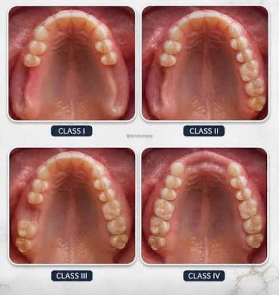 تعويض اسنان • علاج مجاني • واتساب