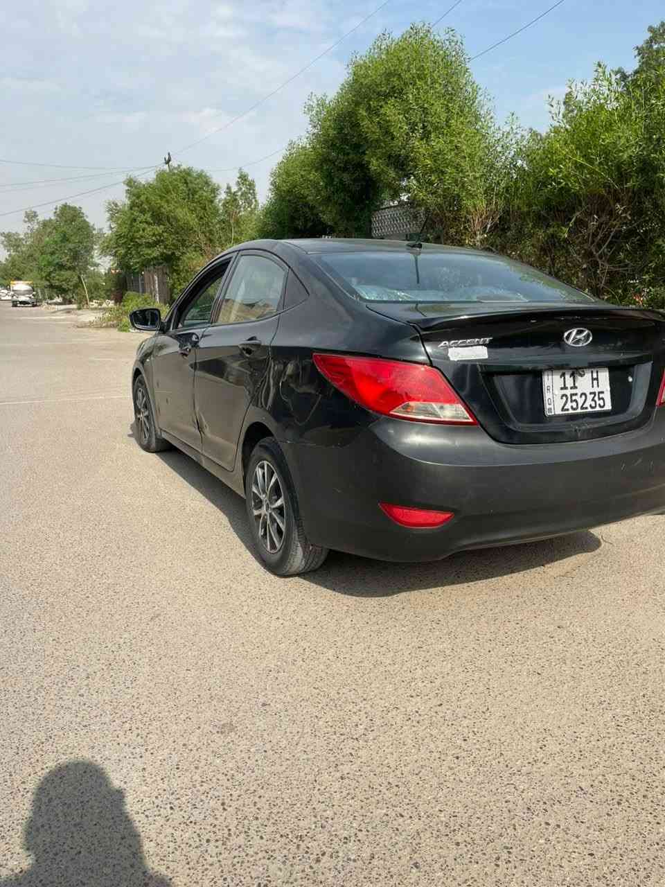 اكسن • ٢٠١٧ • حادثه يمين