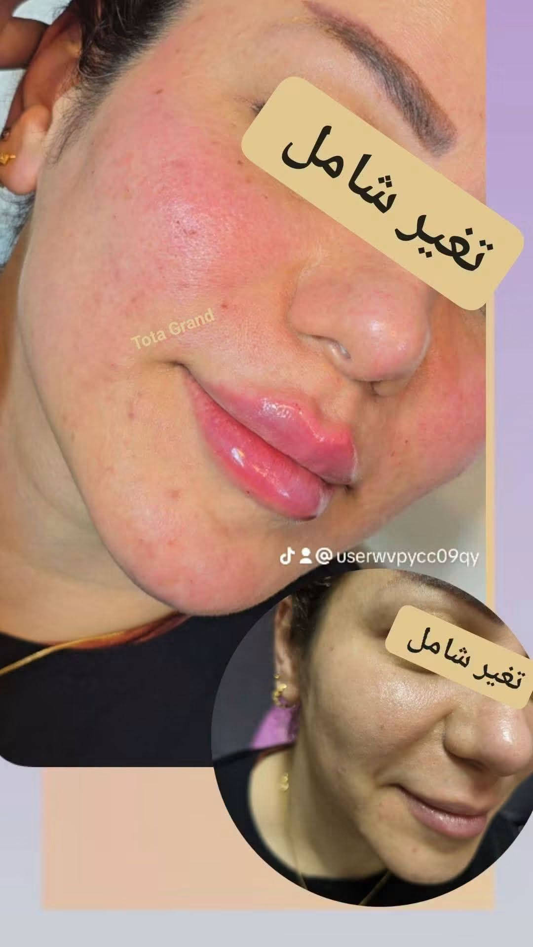 توته كراند • تغير شامل