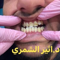 مستمرين ❤️‍🔥🥹 ابتسامه لاحد مراجعينا 🥰  ابتسامه المشاهير..اقرب منما تتو...