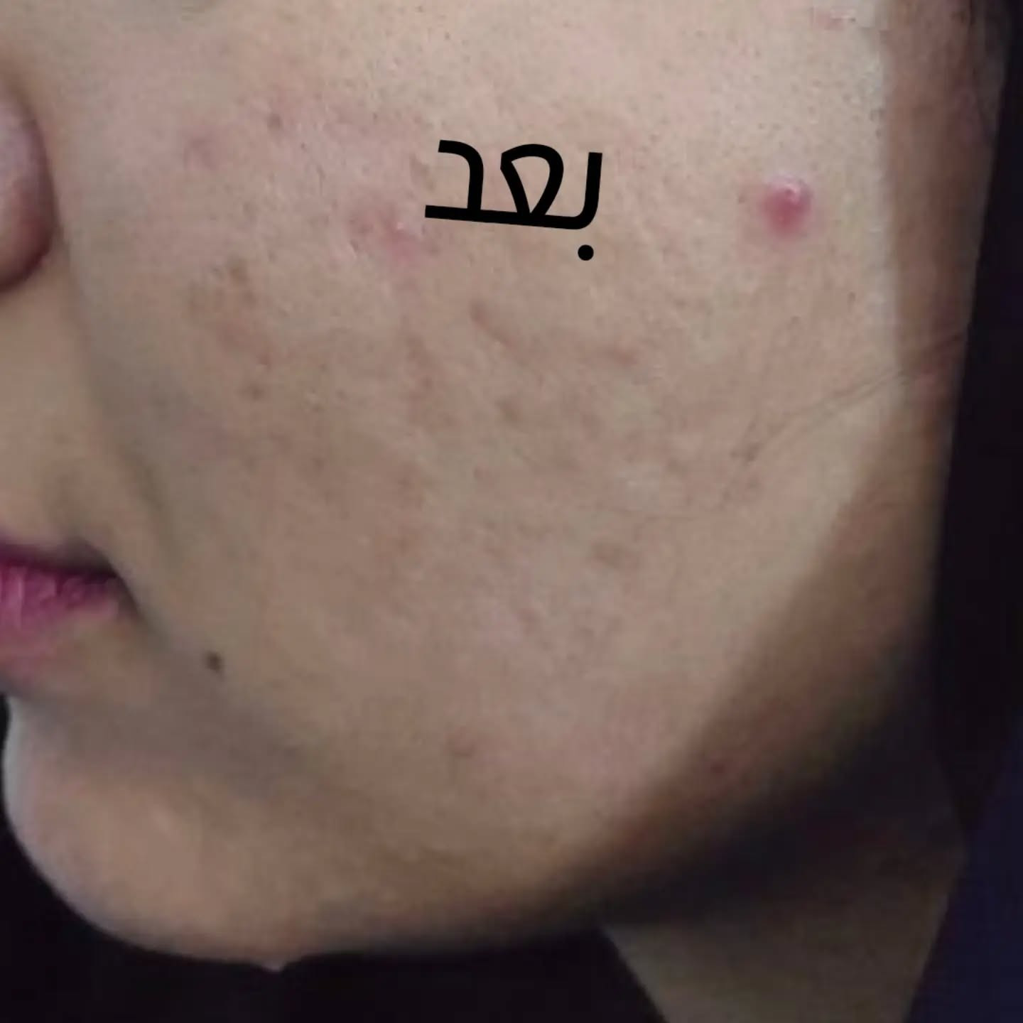 د. ساره الجبوري

نص مكتوب في الصور:
- قبل
- بعد
- د ساره الجبوري