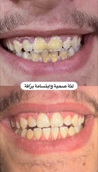 معاينة وفحص مجاني • البلديات بغداد • دكتور علي تيسير