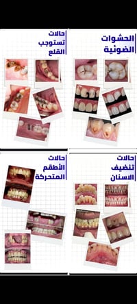 علاج مجاني • علاج أسنان • كربلاء حي الحر الصغير