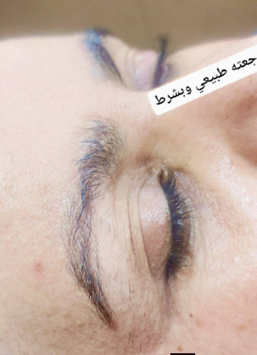 ازالة تاتو حاجب • جلستين • نمو شعر الحاجب