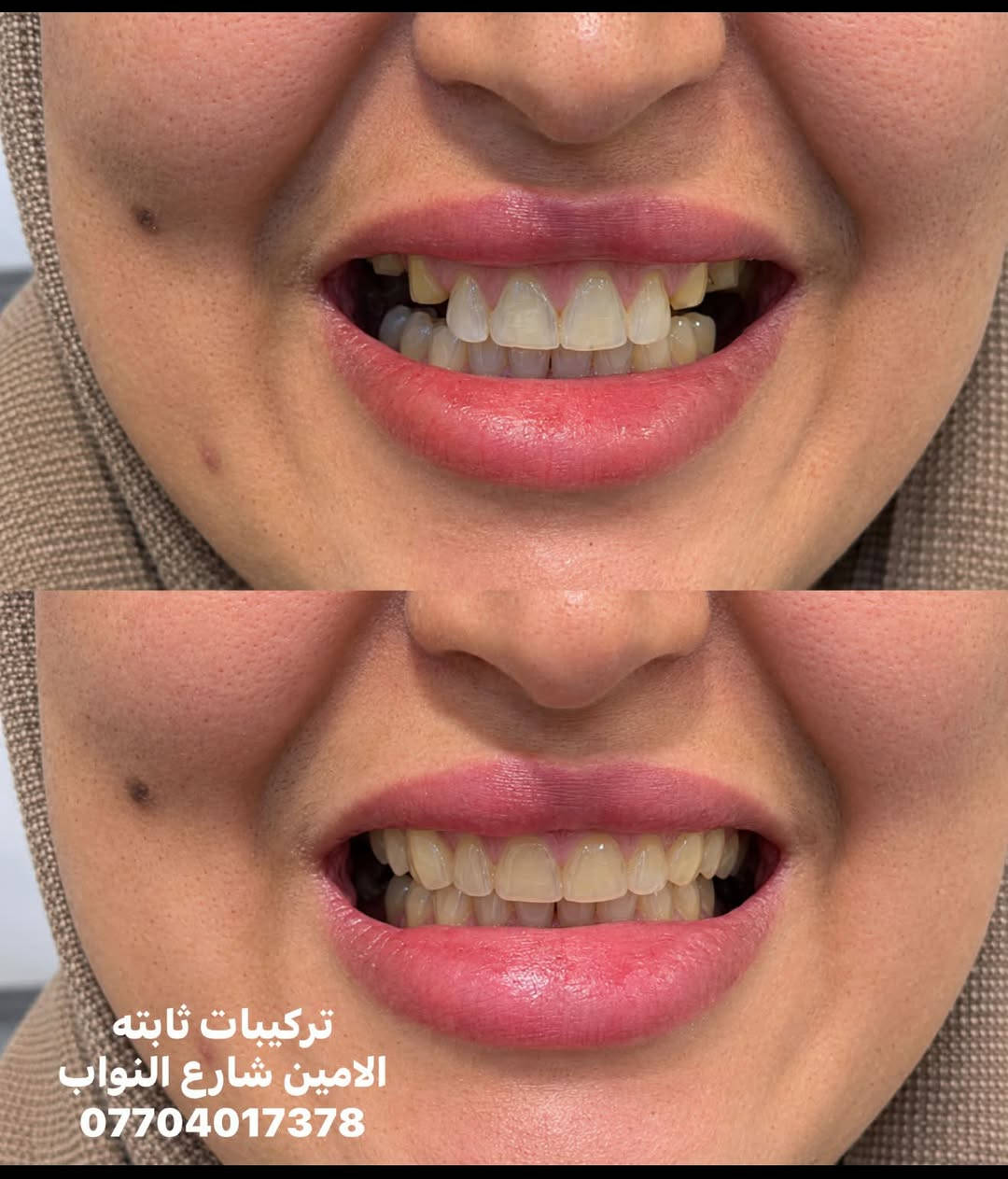 تركيبات ثابتة • الامين شارع النواب • خدمات