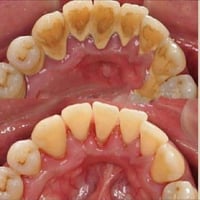 � خدمات علاجية مجانية للفم والأسنان 🦷 تعلن كلية طب الأسنان / جامعة باب...