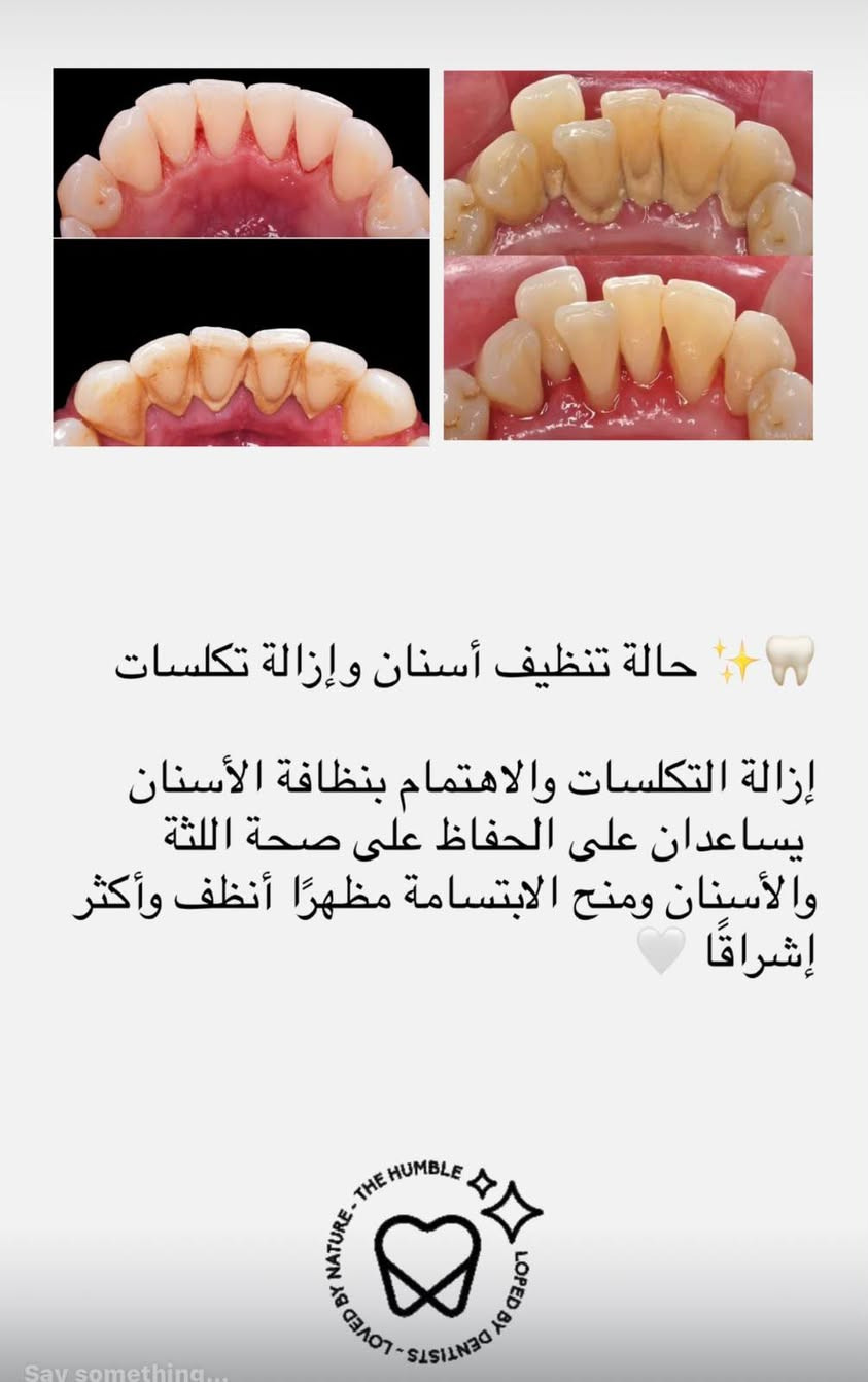 علاج مجاني • تحت إشراف طبي • جامعة اوروك