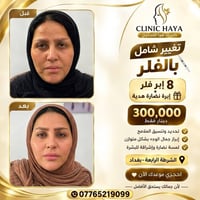 كلينك هيا • باكيج التغيير • ٨ إبر فيلر