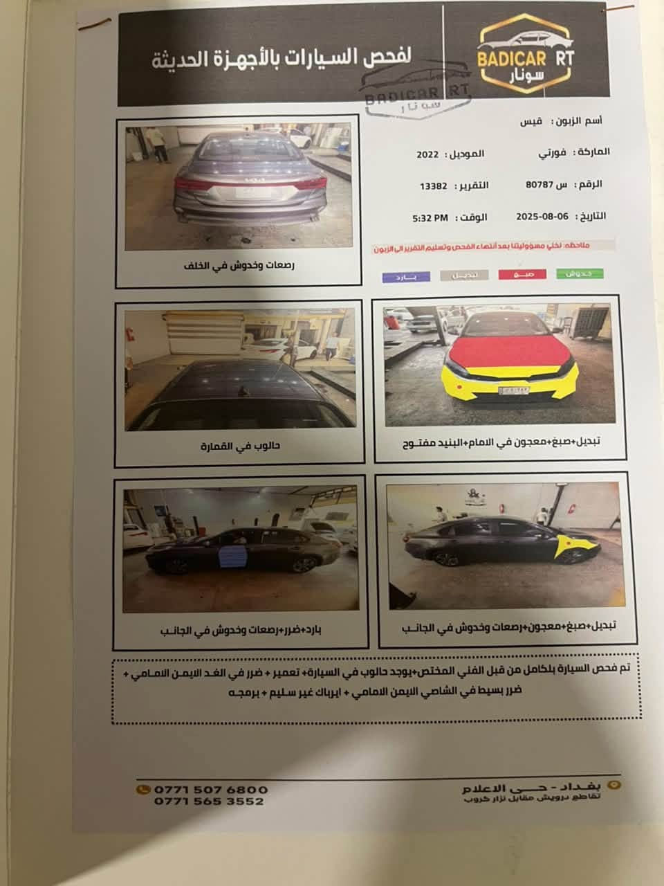السلام عليكم البيع كيه فورتي موديل 2022مواصفات عاديه السياره ماشيه 60 كيلو 3 وضعيات قياده رادار توقف ذاتي  شاشه كاربلي السعر 135 وبيه مجال الرقم الهاتف ***********
