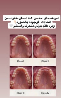 مجاني • جامعة كربلاء • طقم جزئي
