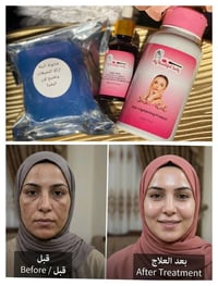 سيروم • تفتيح • مغذي البشرة