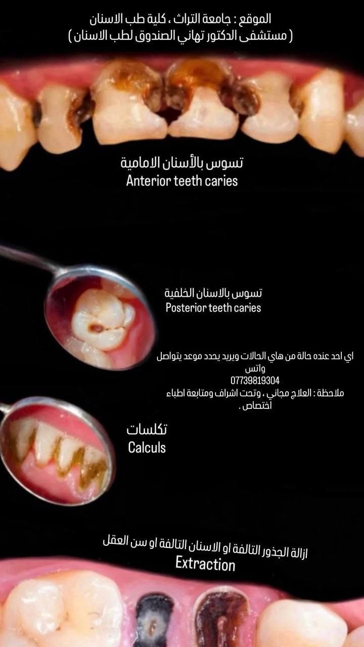 المنصور • جامعة التراث • العلاج مجاني
