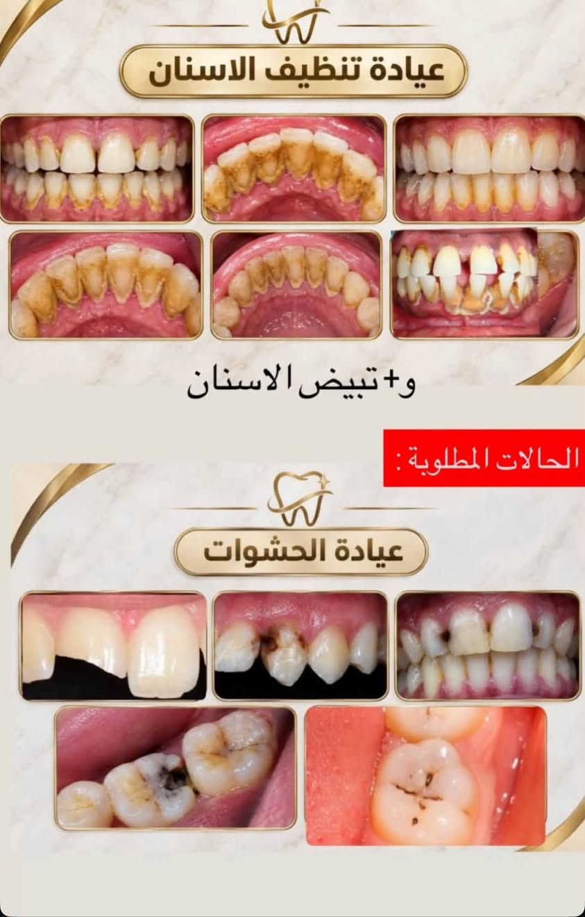 علاج مجاني • قلع أسنان • عيادة الفراهيدي