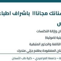 علاج أسنان مجاني • إزالة تكلسات • طقم جزئي متحرك