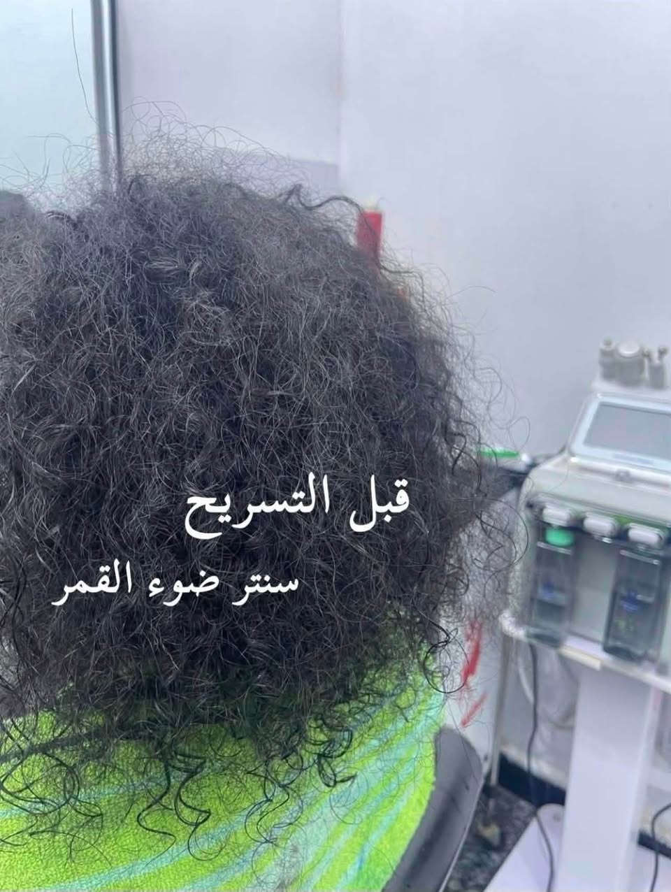 رجع العرض من جديد
لفتـرة محدودة🤍
مركز ضوء القمر 
💆🏻‍♀️ حف + تنظيف بشرة + شمع للوجه 5 آلاف
💇🏻‍♀️ تسريح 30 ألف
🎨 صبغ + معالج 10 آلاف
تنظيف قدم 5 فقط
الرقم للاستفسار:***********
الدولعي الشارع العام مجاور ازياء الامير مباشرتاً
سنتر ضوء القمر
