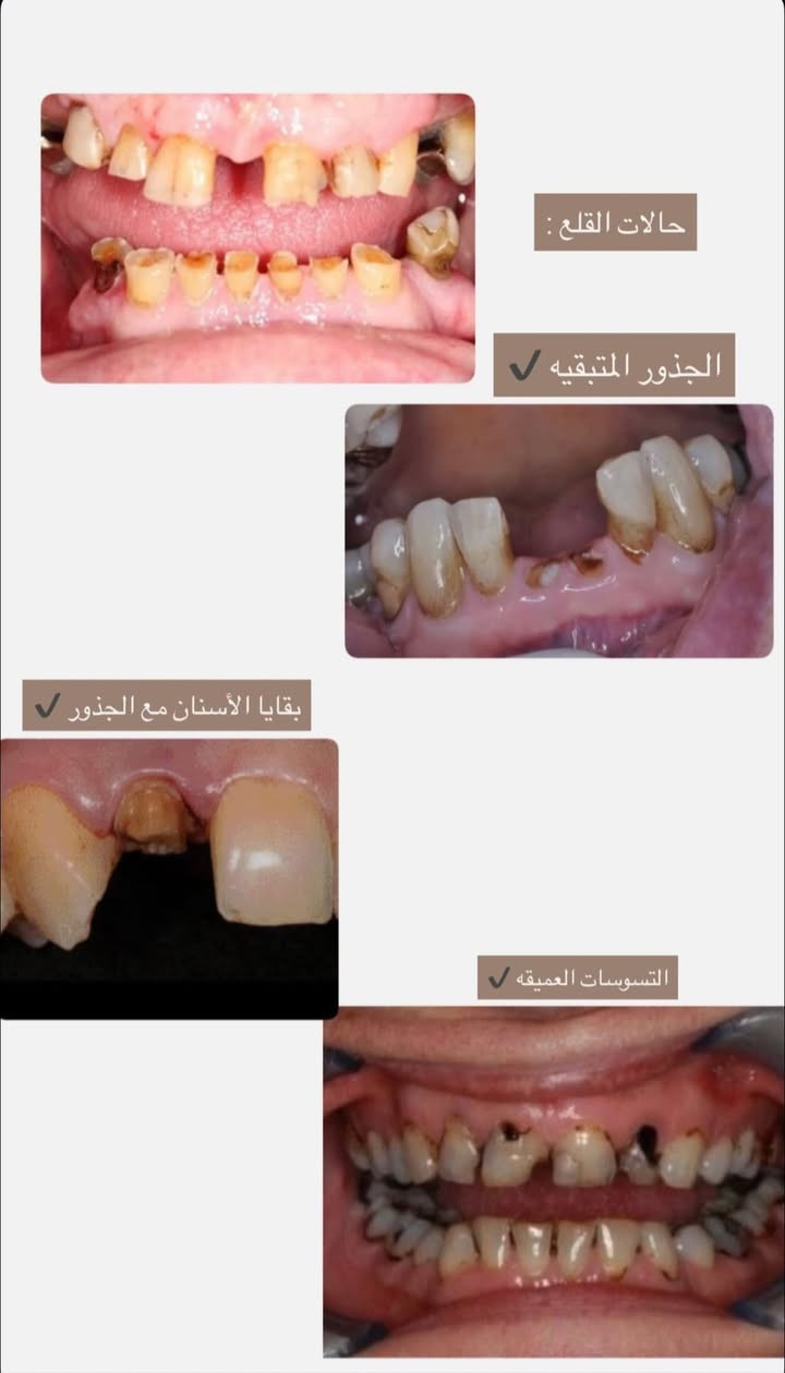 علاج أسنان مجاني • جامعة البيان • قرب مطار بغداد