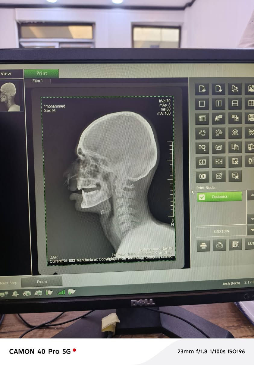 عياده التبارك 
للاشعه العاديه والملونه🩻👨🏻‍⚕️
الموقع الشرقاط
شارع الاطباء مجمع الماس الطبي بين عياده الدكتور عبد الرزاق الترف ولدكتور زين العابدين
📍رقم الهاتف ***********
