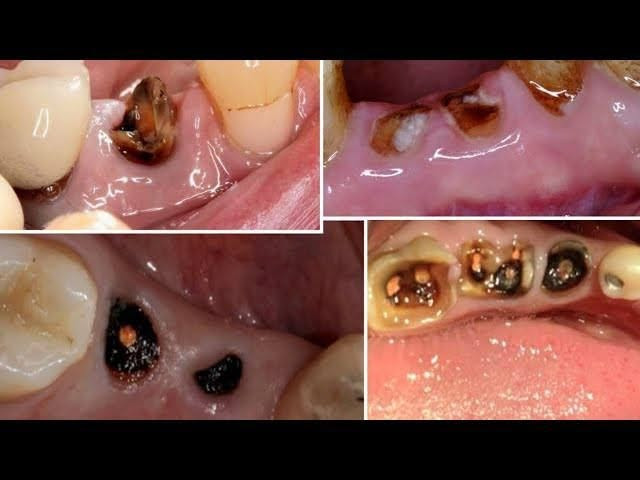 السلام عليكم
اهالينا الكرام نعلن ولوقت محدود علاج مجاني للحالات التالية 
قلع اسنان متسوسة 
ازالة التكلسات والتصبغات وتنظيف الاسنان 
حشوات ضوئية 
مع وجود كادر رجالي ونسائي من الاطباء المتخصصين
العلاج مدفوع الثمن ومجانا لفترة محدودة 
للاستفسار والحجز الاتصال على الرقم ***********
او مراسلة الصفحة
