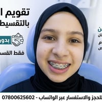 تقويم الاسنان • تقسيط شهري • الحله حي الامام علي