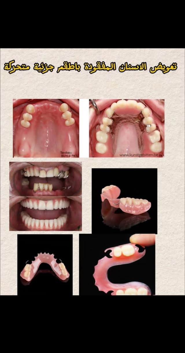 كلية طب الأسنان • خدمات مجانية • تنظيف أسنان