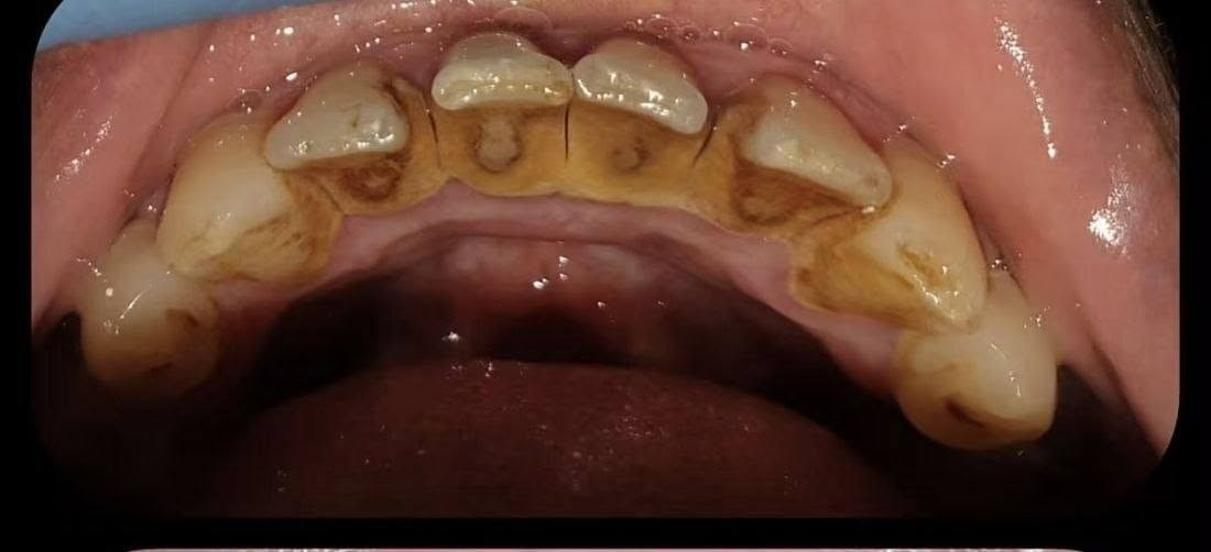 عيادات جامعة واسط • علاج أسنان • أجور رمزية